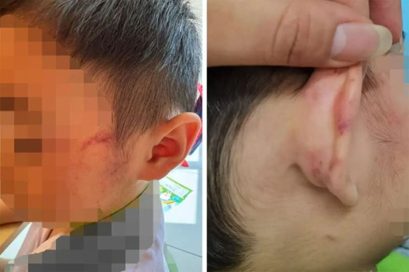 今年1月至8月 槟州共通报697宗虐童案