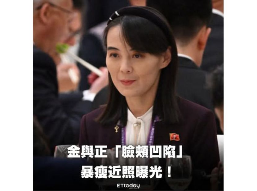 金与正近日被拍到脸颊消瘦。